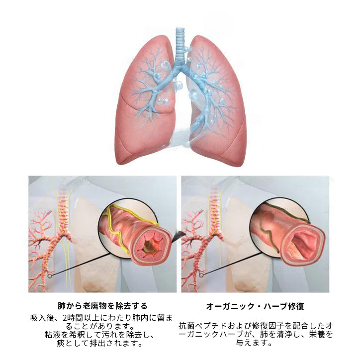 公式ストア✨Murwon® ムレイン植物ディフューザー（肺のケア用） 🫁 咳、咽頭炎、呼吸困難、痰、鼻づまり、気管支炎、アレルギー症状、肺の不快感🌷