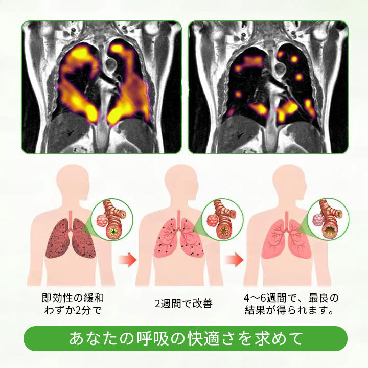 公式ストア✨Murwon® ムレイン植物ディフューザー（肺のケア用） 🫁 咳、咽頭炎、呼吸困難、痰、鼻づまり、気管支炎、アレルギー症状、肺の不快感🌷