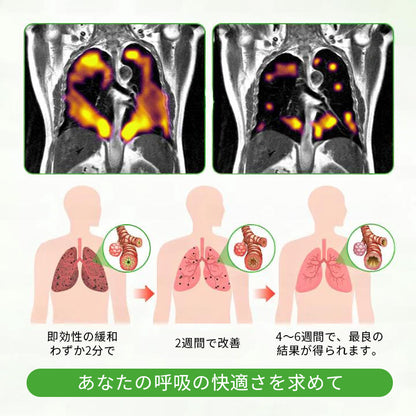 公式ストア✨Murwon® ムレイン植物ディフューザー（肺のケア用） 🫁 咳、咽頭炎、呼吸困難、痰、鼻づまり、気管支炎、アレルギー症状、肺の不快感🌷